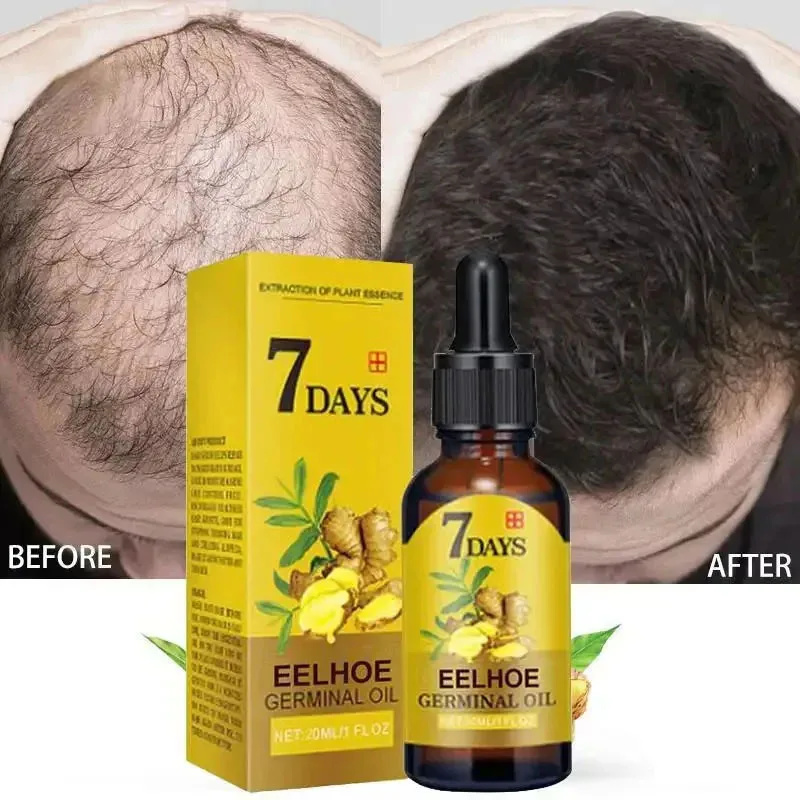 Hair Care Essential Oil Atomizing - 7 Day Fast Hair Growth Serum