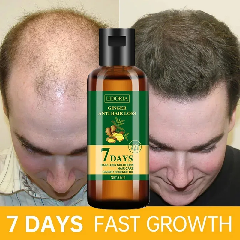 Ginger Hair Growth Essential O - Hair Care Essential Oil Atomizing 评论和价格