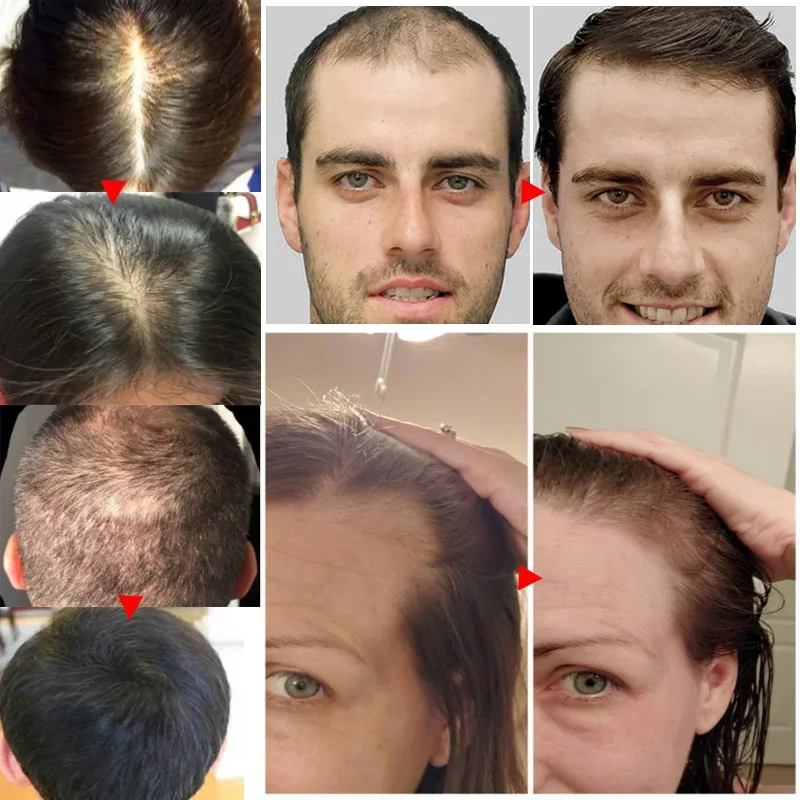 Ginger Hair Growth Essential O - Hair Care Essential Oil Atomizing 评论和价格