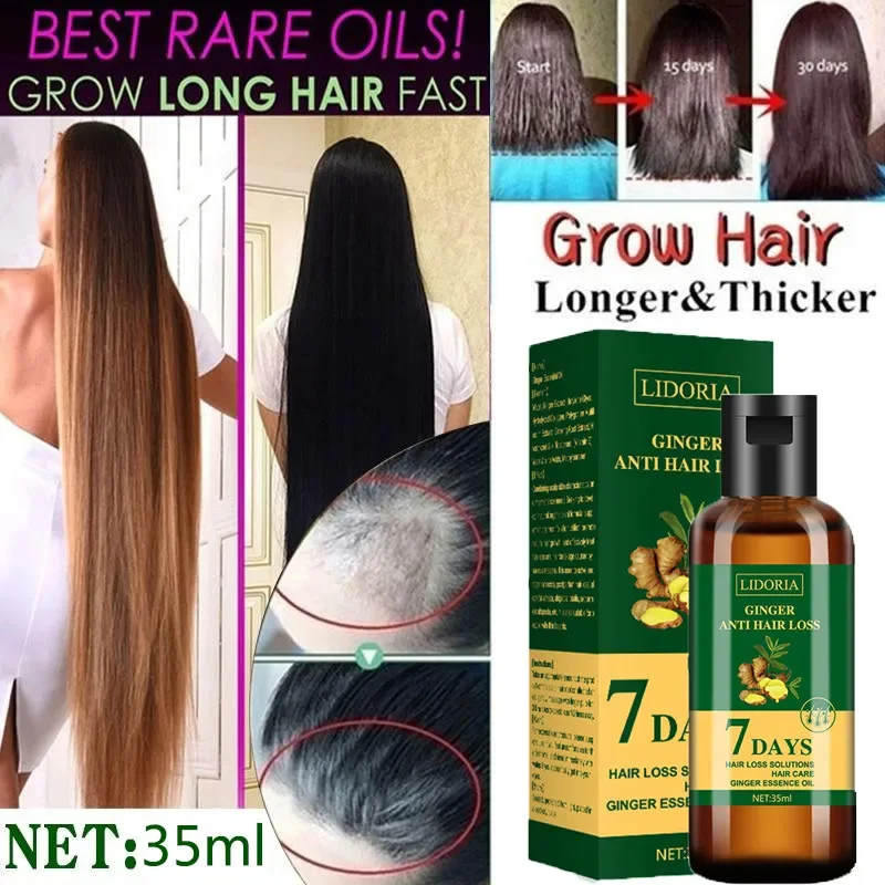 Ginger Hair Growth Essential O - Hair Care Essential Oil Atomizing 评论和价格