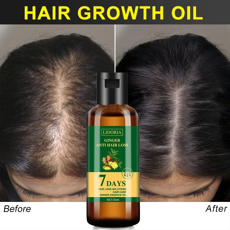 Ginger Hair Growth Essential O - Hair Care Essential Oil Atomizing 评论和价格