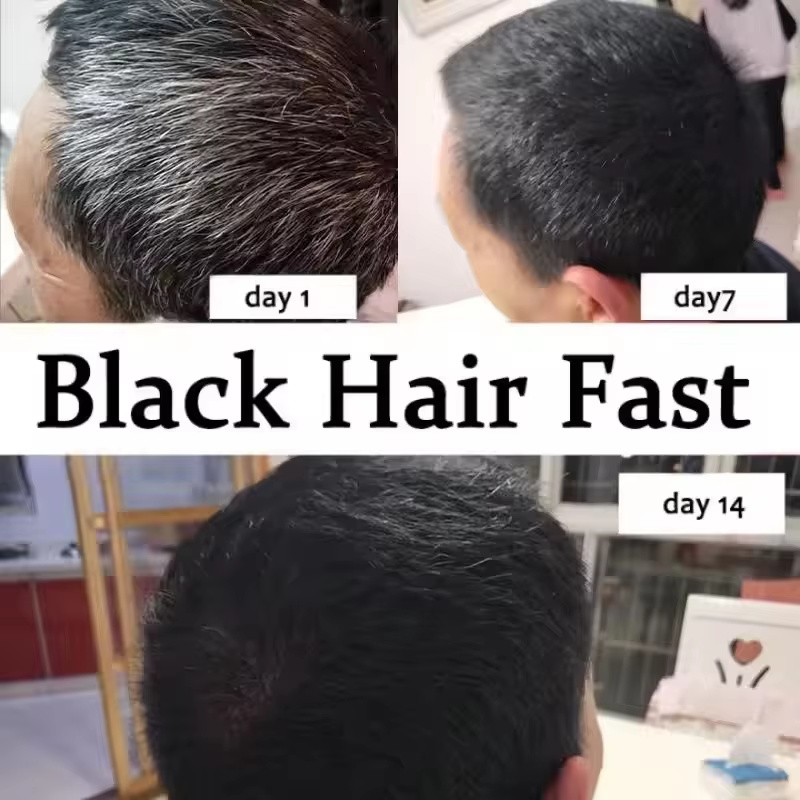 Natural Gray White Hair Treatm - Hair Care Natural Products 评论和价格