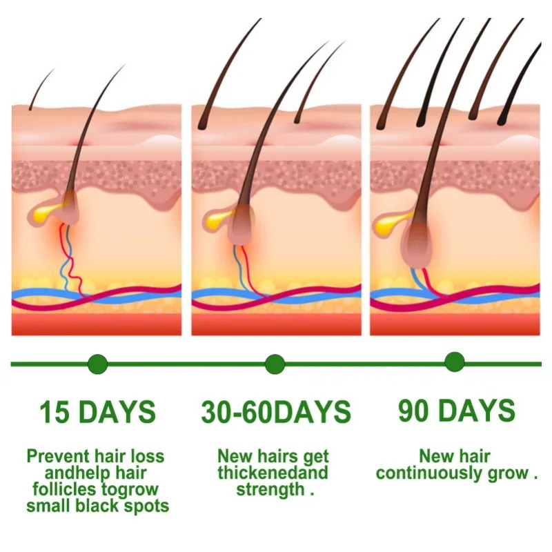 Hair Growth Serum Fast Growing - Hair Care Essential Oil Atomizing 评论和价格