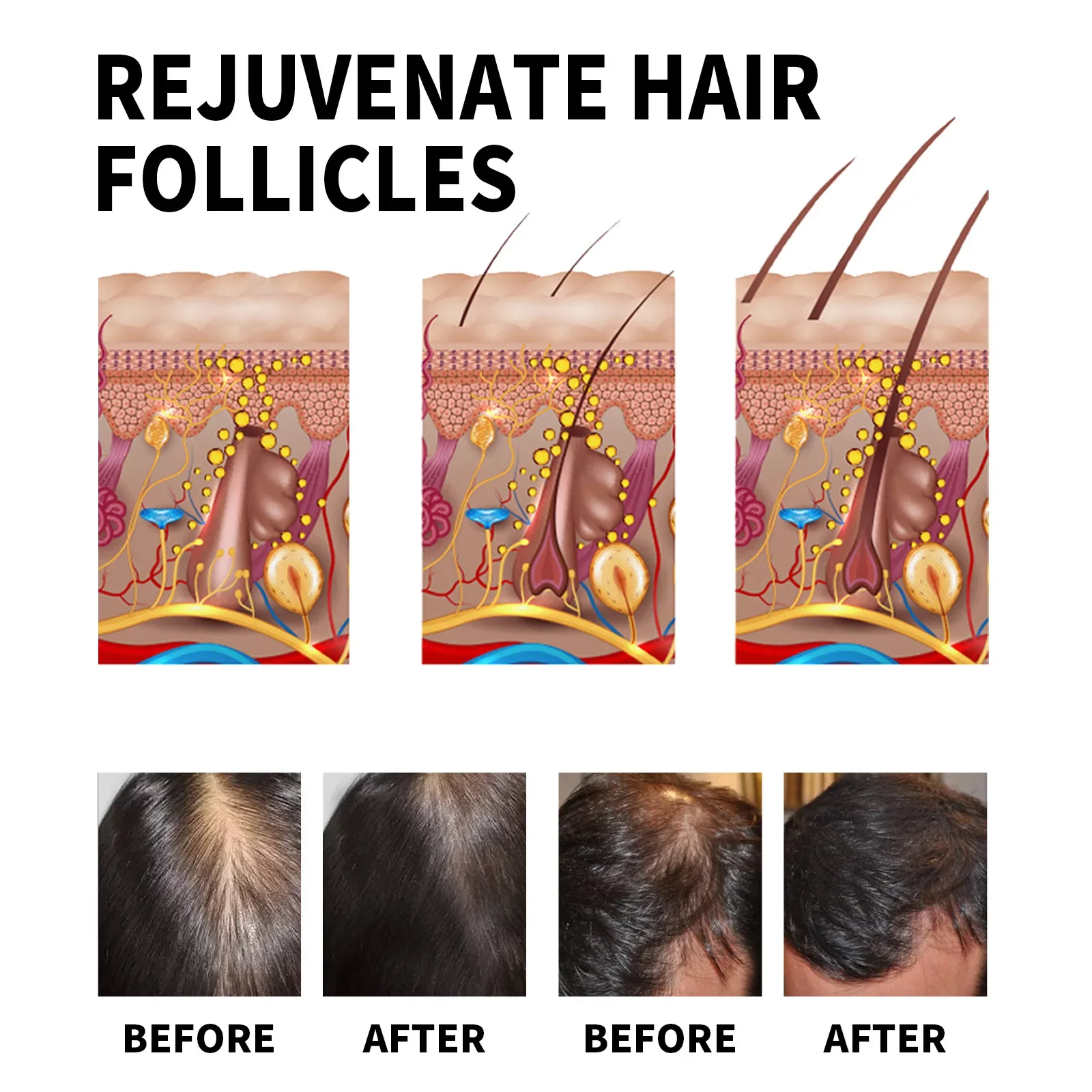 Ginger Hair Growth Products Fa - Hair Care Natural Products 评论和价格