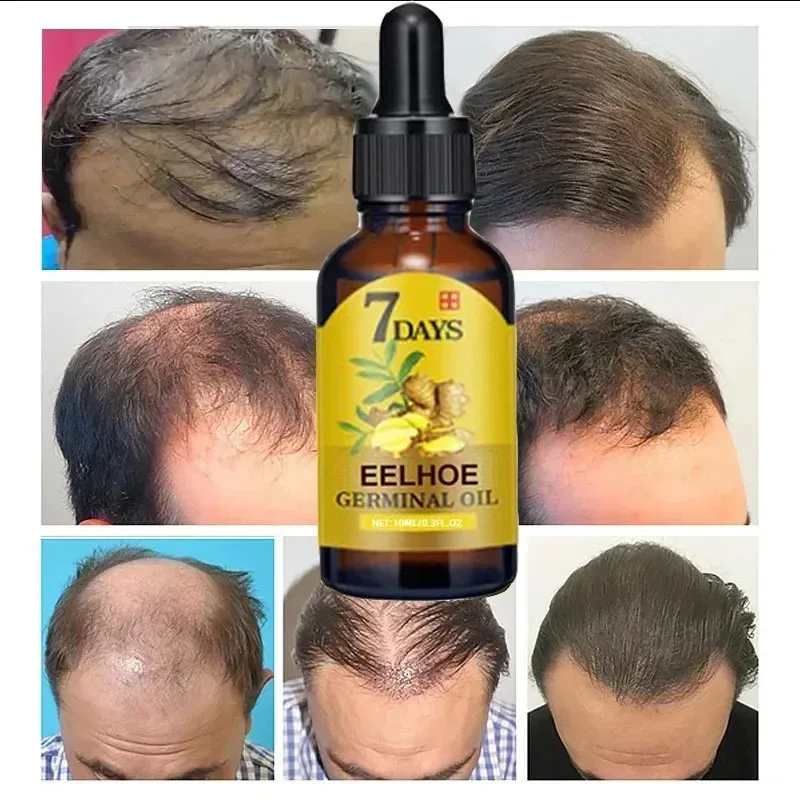 7 Day Fast Hair Growth Serum G - Hair Care Essential Oil Atomizing 评论和价格