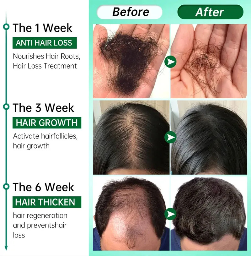 7 Day Fast Hair Growth Serum G - Hair Care Essential Oil Atomizing 评论和价格